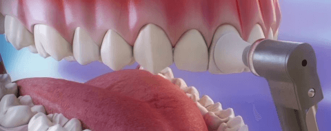 higienizacja zębów